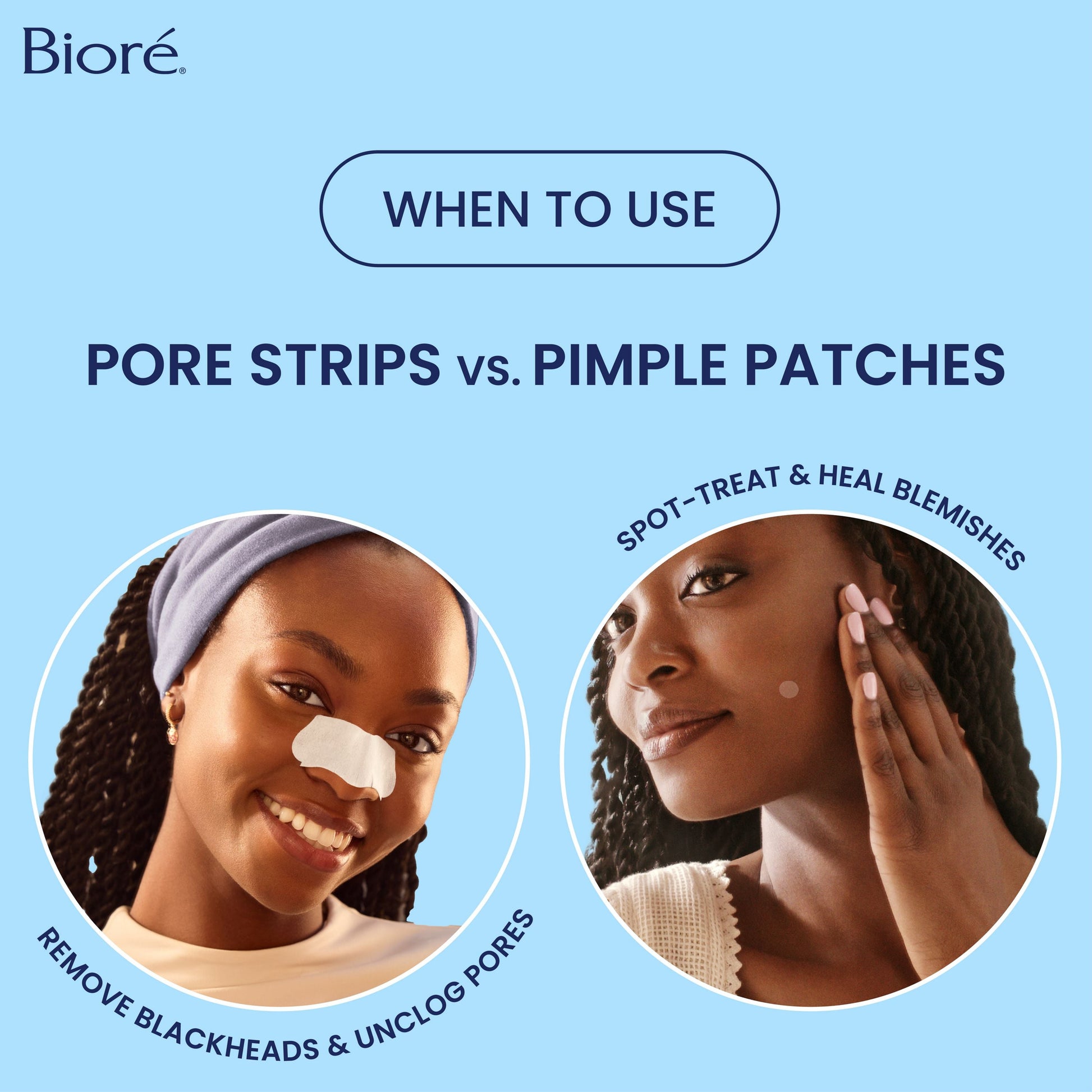 The Original Deep Cleansing Pore Strips