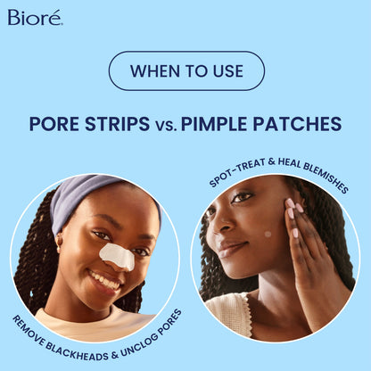 The Original Deep Cleansing Pore Strips