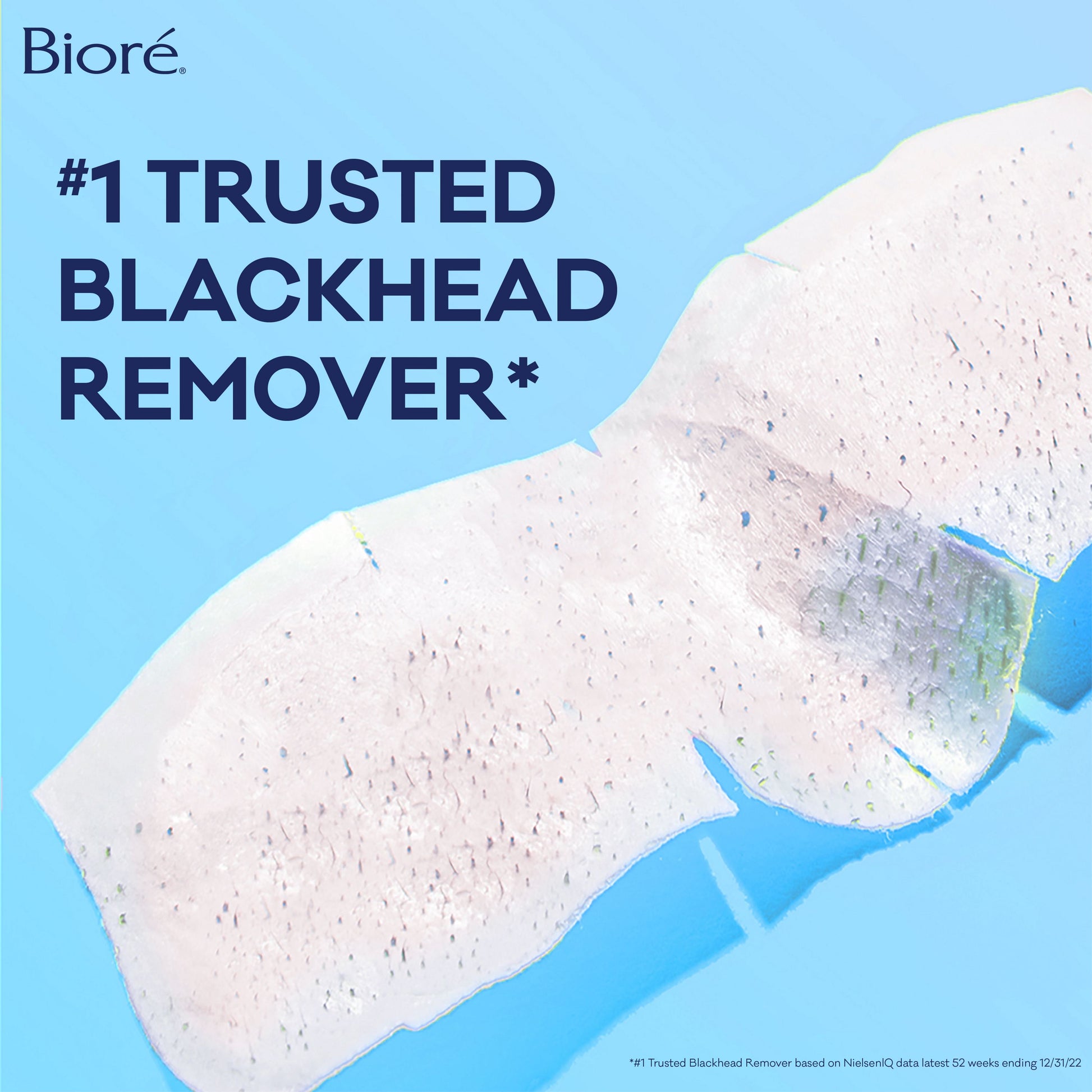 The Original Deep Cleansing Pore Strips